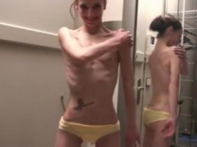 Fille anorexique dans sa salle de bain Fille anorexique dans sa salle de bain